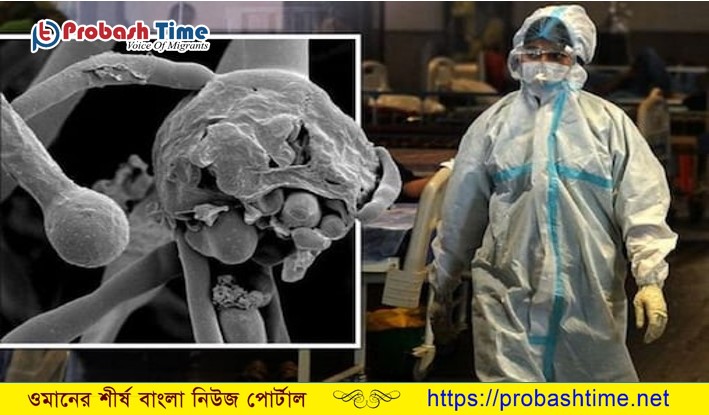 ওমানে নতুন আতংক ব্ল্যাক ফাঙ্গাস