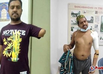 আজীবনের জন্য মাসিক ভাতা পাচ্ছেন মালয়েশিয়ায় হাত হারানো দেলোয়ার