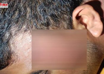 প্রবাসীকে ডেকে নিয়ে বেধড়ক পেটালেন ছাত্রলীগ নেতা