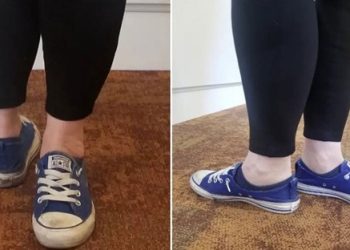 পায়ের গোড়ালি ১৭০ ডিগ্রি ঘুরিয়ে বিশ্বরেকর্ড